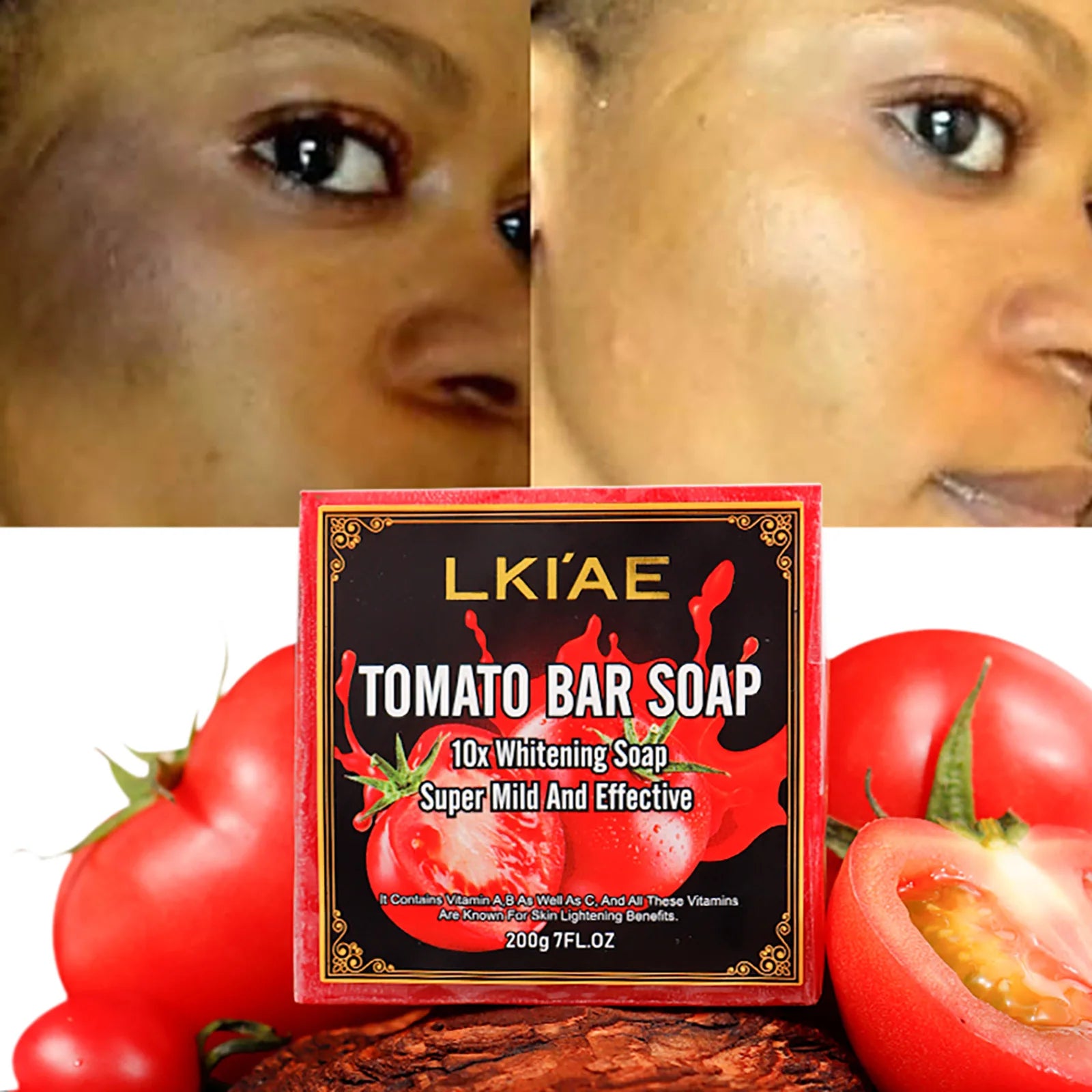 Skin Care