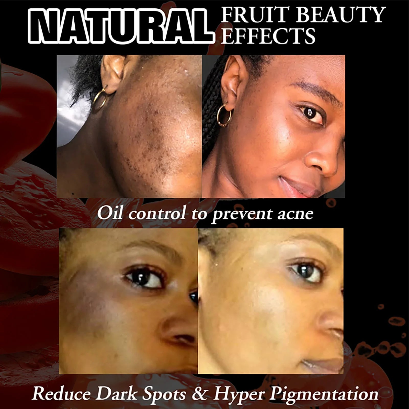 Skin Care